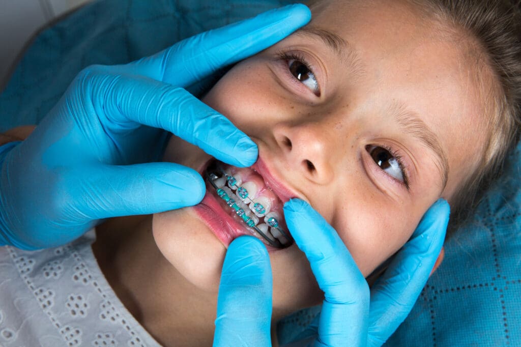 Orthodontist examining a little girl patient's teeth with green braces