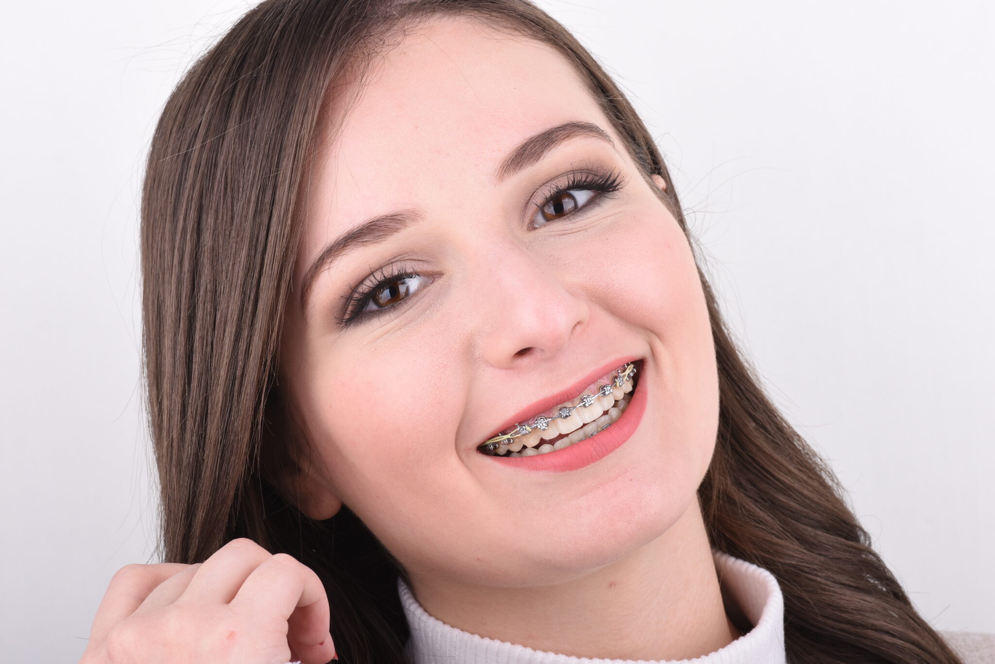 A Young Woman With Pitts 21 Braces