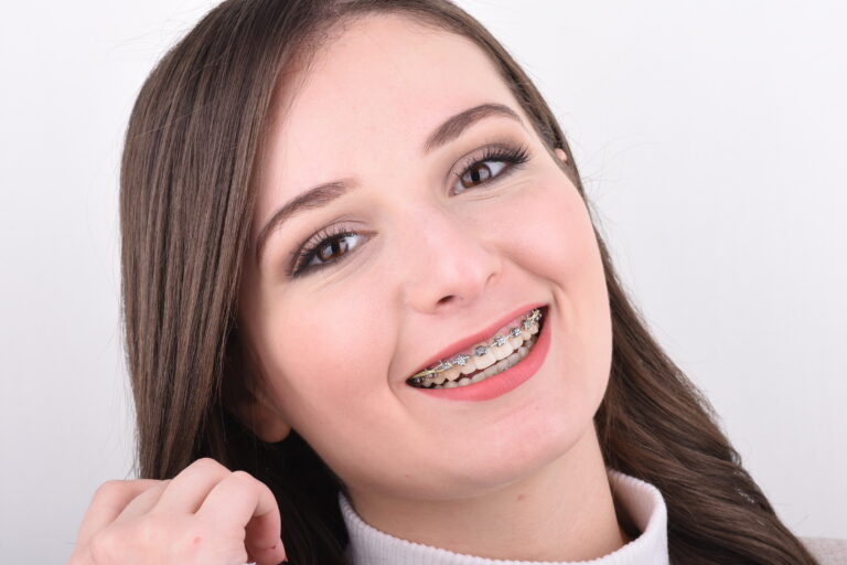 A Young Woman With Pitts 21 Braces