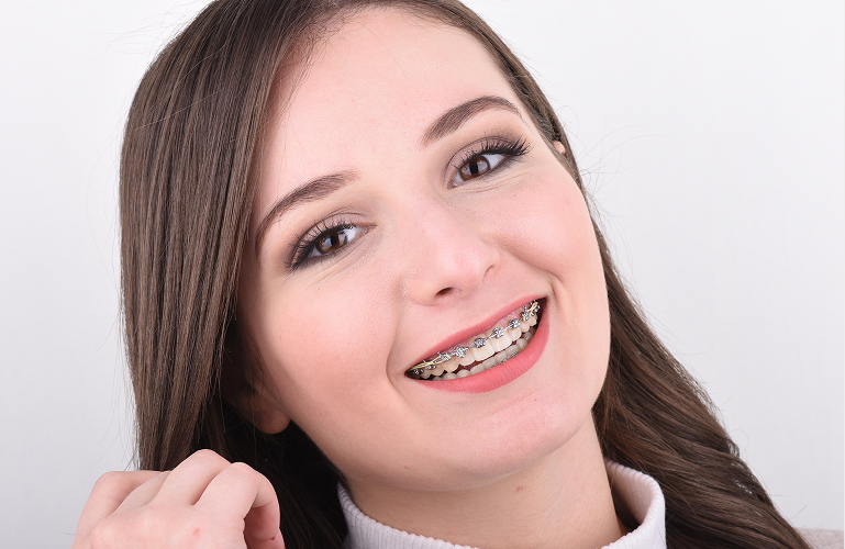 Smiling Teen Girl Wearing Braces