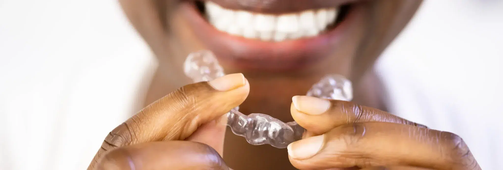 Clear Aligner